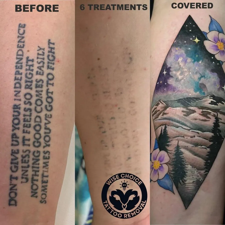Comparison of a tattoo before, after six treatments, and covered with a colorful mountain landscape tattoo. The original tattoo is a black ink text tattoo that reads: "DON'T GIVE UP ON YOUR INDEPENDENCE. UNLESS IT SEEMS REALLY BAD, DON'T GIVE UP BEFO