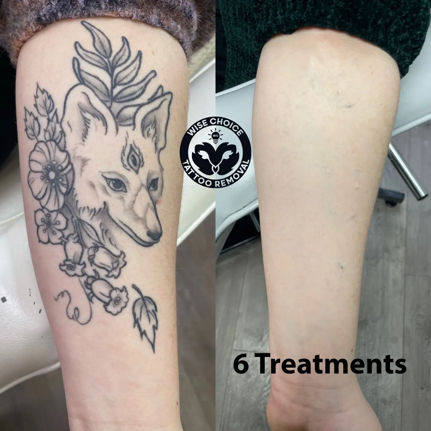 Tattoo removal before and after photos showing a fox and floral design, indicating six treatments were done.