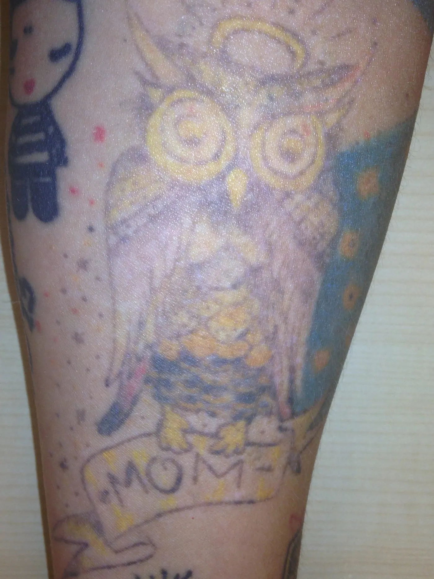 Color tattoo removal of the owners tattoo. Tattoo fading for coverups