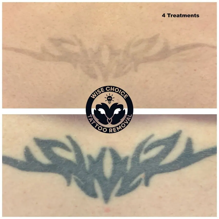 A tattoo of a stylized black bat with outstretched wings on skin, with the shadow of the bat visible above.